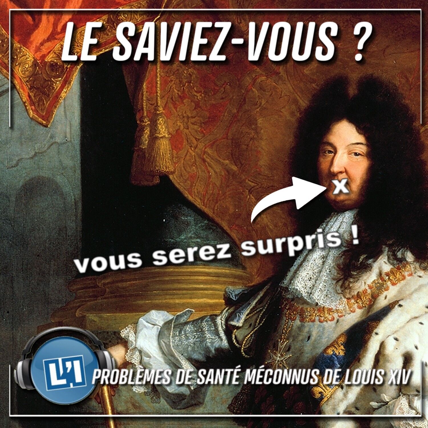 LES PROBLÈMES DE SANTÉ MÉCONNUS DE LOUIS XIV episode artwork